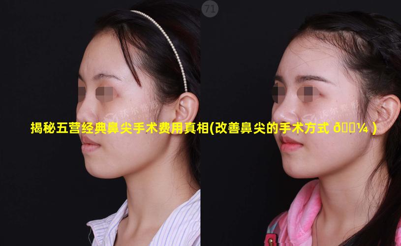 揭秘五营经典鼻尖手术费用真相(改善鼻尖的手术方式 🌼 )